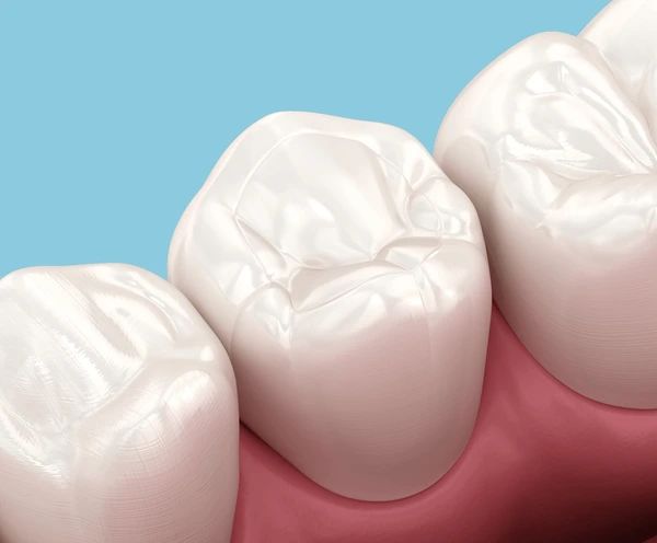 composite fillings near you
