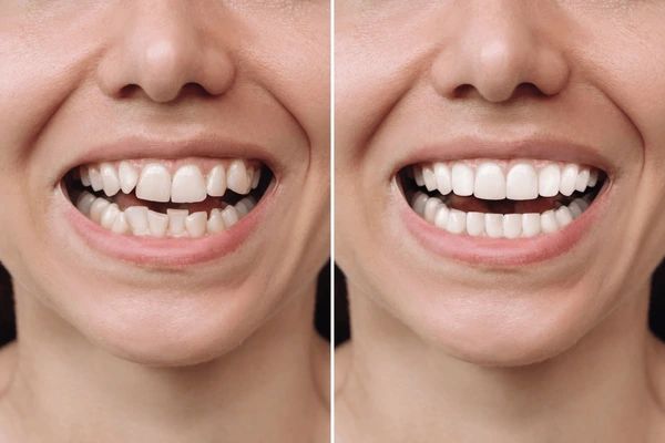 cosmetic dentistry near you