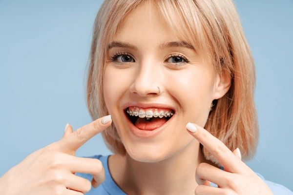 orthodontics in marion, ma