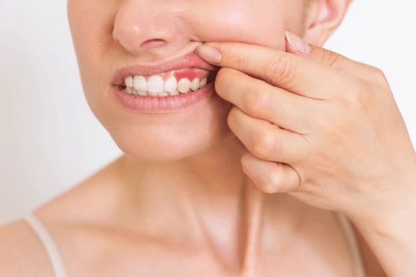 periodontics in marion, ma