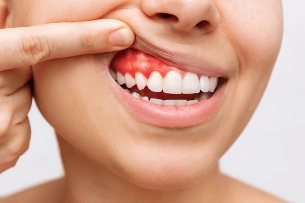 periodontics near you