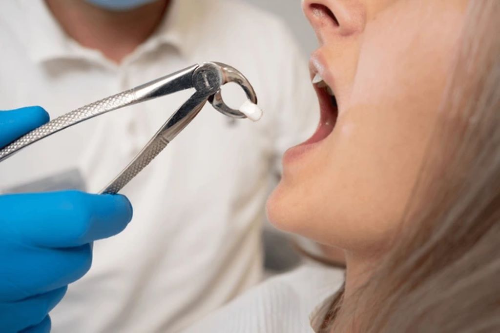 tooth extractions near you