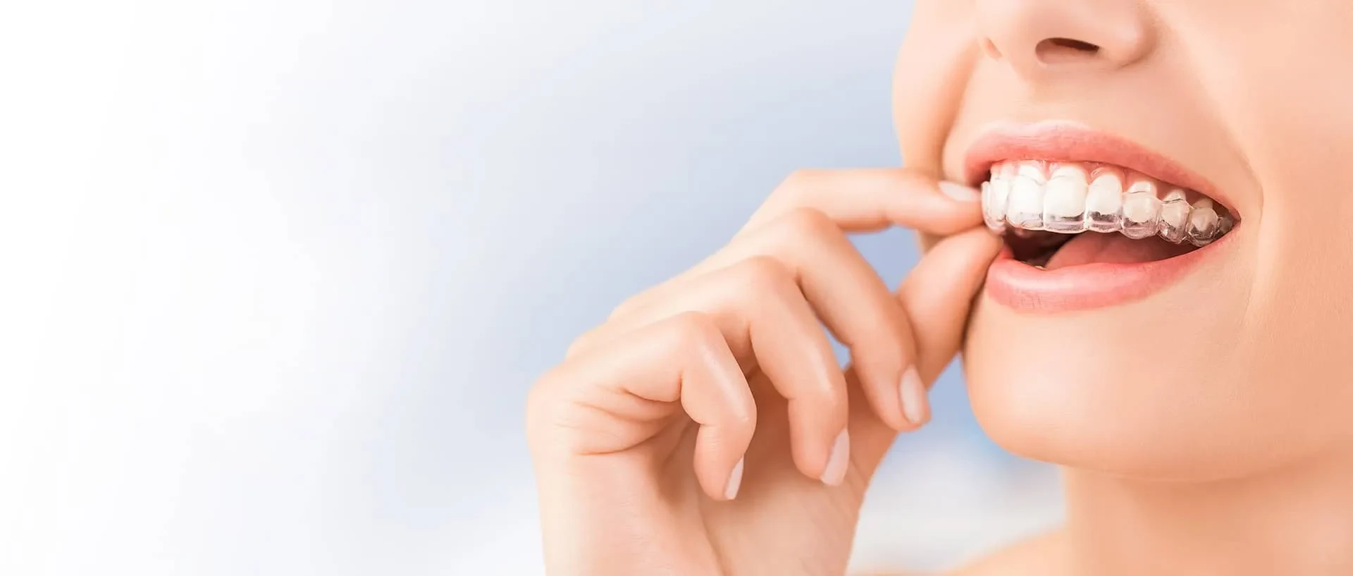 banner-image-invisaligns
